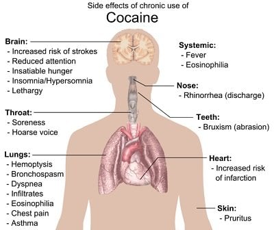 where to get cocaine